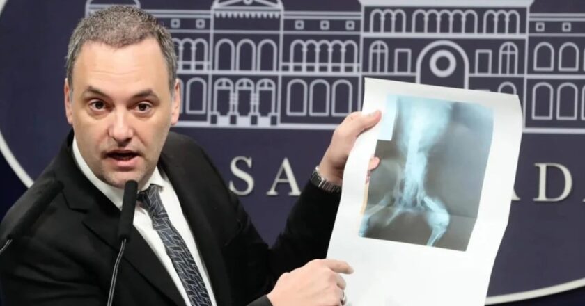 Spagnuolo contradice a Adorni sobre auditoría en área de discapacidad