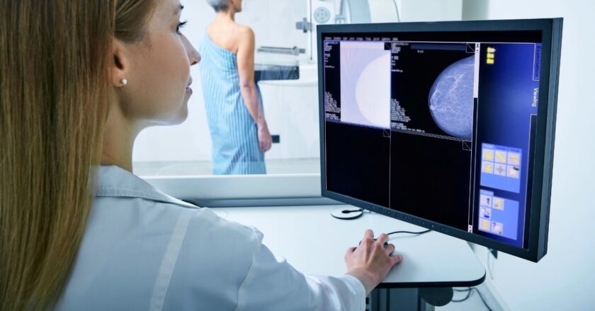 San Lorenzo intensifica controles gratuitos para la prevención del cáncer de mama